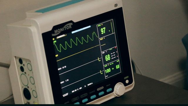 A monitor with a heart rate of 87 on it